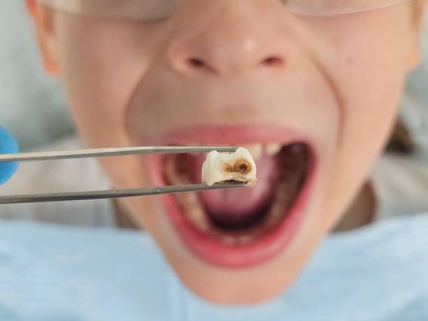 Best Urgent Dental Care for Toothaches in Charlotte Park, FL